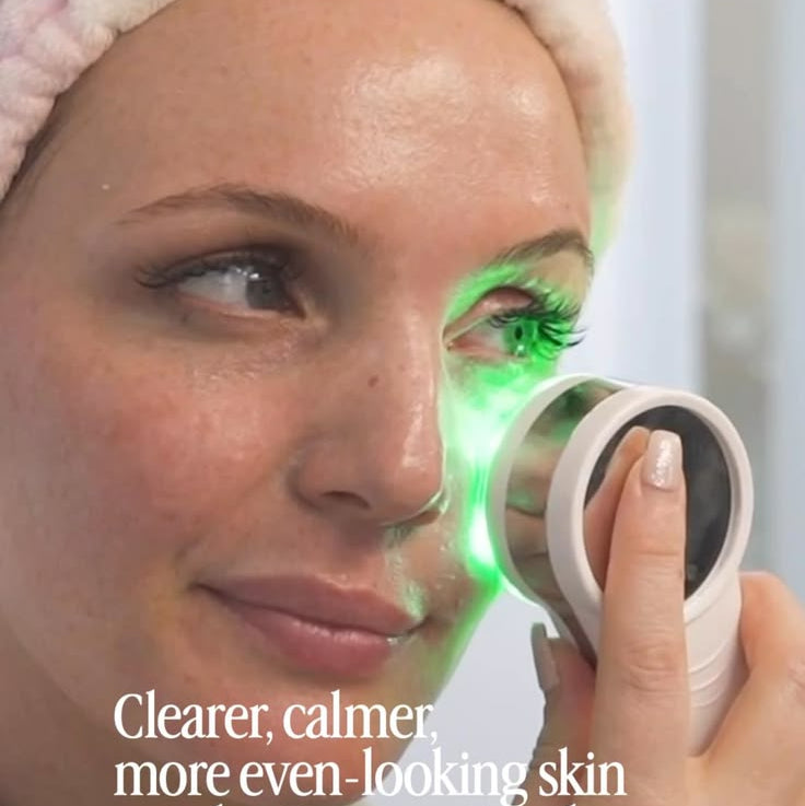 My Skin Buddy Boost™  ( MSB )